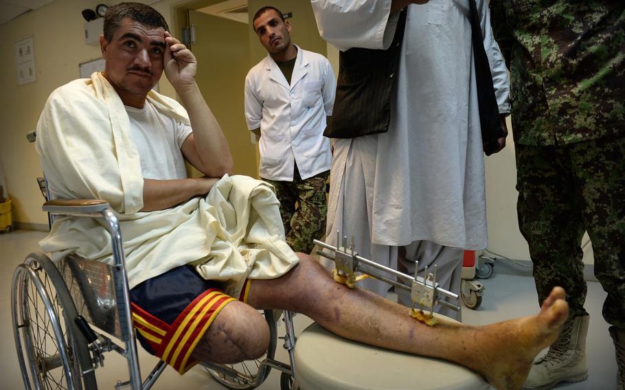 Bismullah Hagmal, a member of a local police militia near the border with Pakistan, stepped on an improvised bomb while patrolling a road. It took police officers and Hagmal's brother around 10 hours to get him to the hospital in Kandaha, where doctors amputated his injured leg.