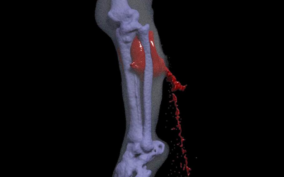 A still clip taken from a computer simulation of a leg wound designed by the Center for Advanced Surgical and Interventional Technology at the University of California, Los Angeles. The goal of the simulation is to give field medics initial training on an anatomically, physically and mathematically accurate model of various leg wounds.