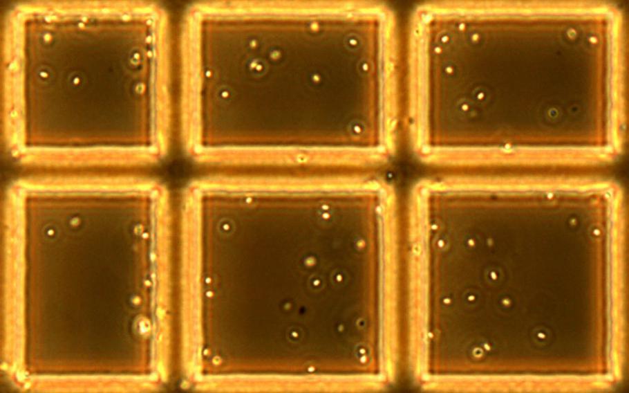 This undated image from the National Institute of Standards and Technology shows anthrax bacillus spores under a microscope in a cell chamber to measure their concentration. Last year, it was revealed that the Army made 575 shipments of anthrax that was not completely inactivated to 194 labs and contractors around the world from 2004 to 2015 from its Dugway Proving Ground Sciences Division in Utah.