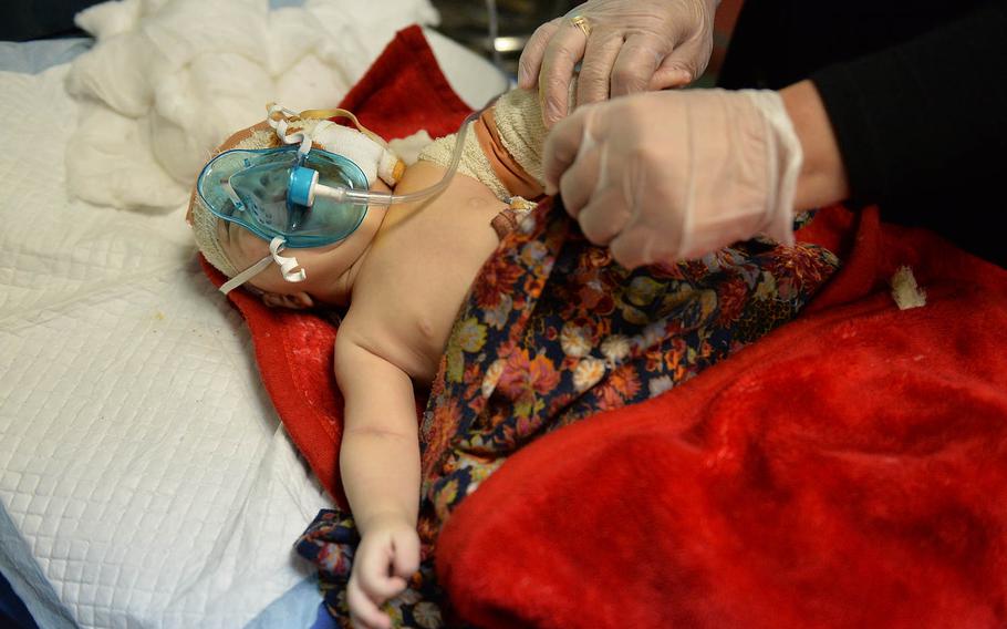A two-month old baby, orphaned during the campaign to retake Mosul from Islamic State fighters, being treated at the West Irbil Emergency Hospital after a mortar attack that killed his mother on Sunday, Nov. 20, 2016.