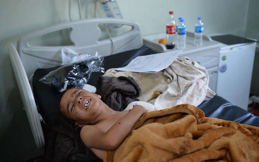 Ahmed Younis Mohammed, 7, screaming in pain from a shell injury to his shoulder, at the West Irbil Emergency Hospital on Sunday, Nov. 20, 2016. Doctors had performed one operation on the boy's shoulder and said more surgery would be needed. 
