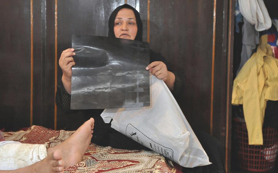 Yasra Abd Ali, Fadel Nathem&#39;s mother and main caretaker, shows an X-ray of his leg. She keeps his records and photos of him after he was wounded by a suicide car bomber in September 2008 in the plastic bag.