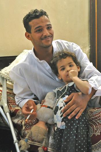 Fadel Nathem, an Iraqi soldier wounded by a suicide car bomber in September 2008, with his daughter, Mariam, 4.