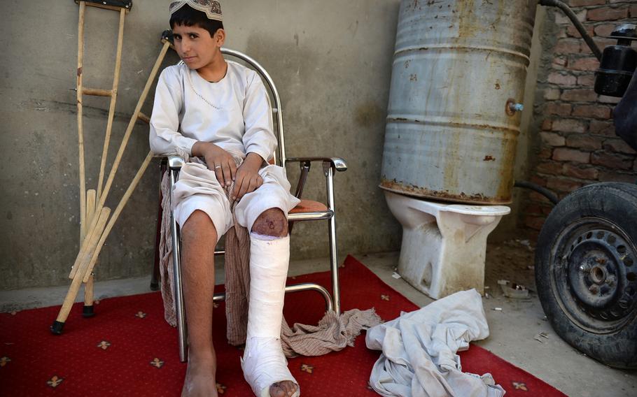 Mohammed Wazir sits at a compound in Lashkar Gah, the capital of Helmand province, Afghanistan, on Sept. 23, 2014. Mohammed stepped on an improvised bomb left in his family's home by insurgents during fighting over the summer. He says he wants to become a doctor to help people the way he has been helped.