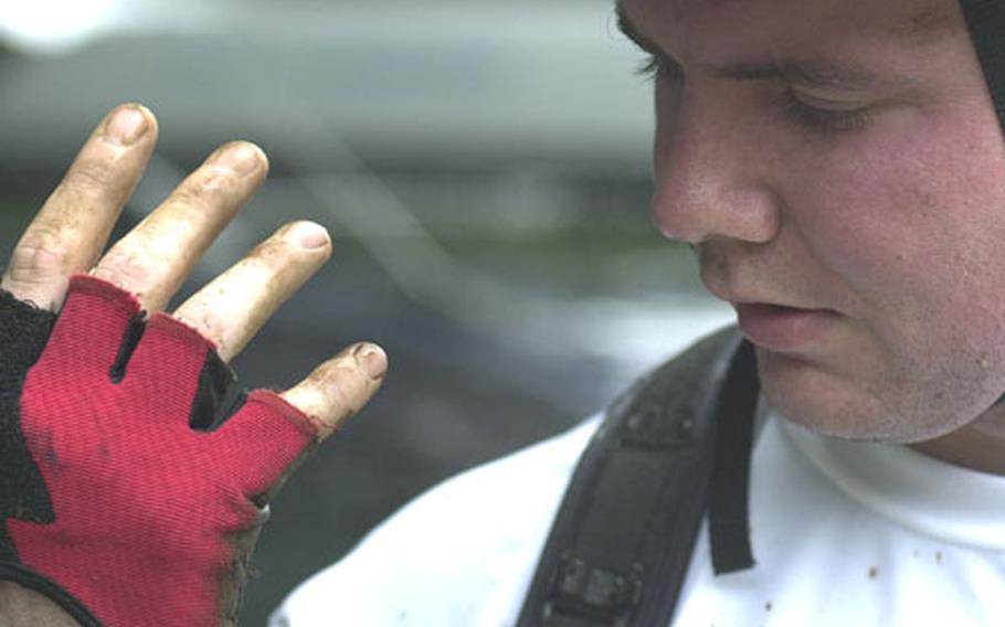 Trey Norris of Yokota Air Base checks out the damage to his right pinky after a warmup for the men&#39;s open division portion of the 12th Tour de Tama mountain bicycle race at Tama Hills Recreation Center, Japan. Norris crashed on a downhill slope near the finish line.