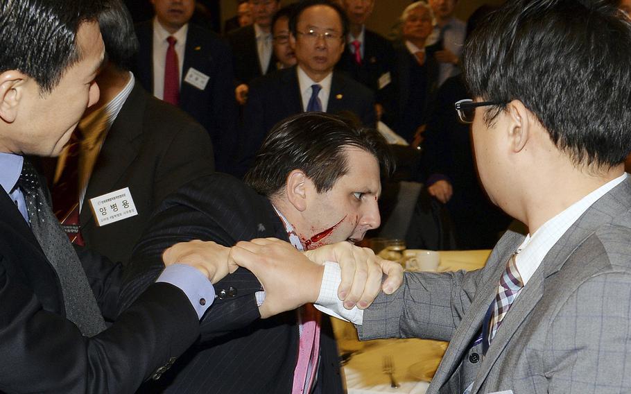 Injured U.S. Ambassador to South Korea Mark Lippert, center, is helped by other participants after he was slashed on the face and wrist by a knife-wielding man at a lecture hall in Seoul, South Korea, on Thursday, March 5, 2015.