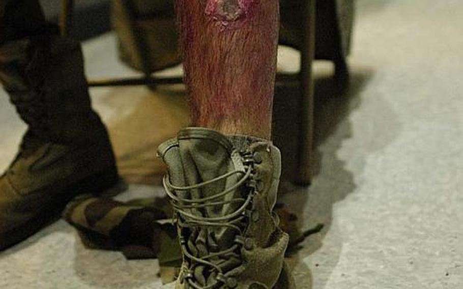 Airman 1st Class Benjamin Bell displays a "wounded leg" during a mock disaster exercise on Nov. 6, 2012, at Yokota Air Base.