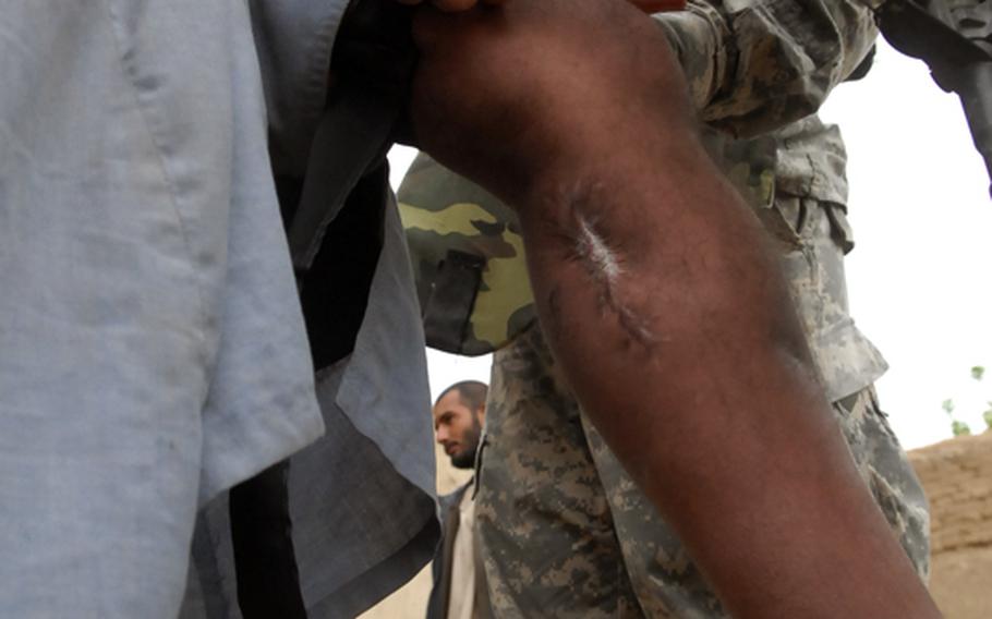 Spc. Joshua Harmon demonstrates how to use a tourniquet on a war-scarred National Police checkpoint commander in southern Afghanistan&#39;s Arghandab district last year. A rash of counterfeit tourniquets have recently turned up online and military officials are concerned U.S. troops could mistake them for the real thing.

A rash of counterfeit tourniquets have turned up online and military officials are concerned U.S. troops could mistake them for the real thing.