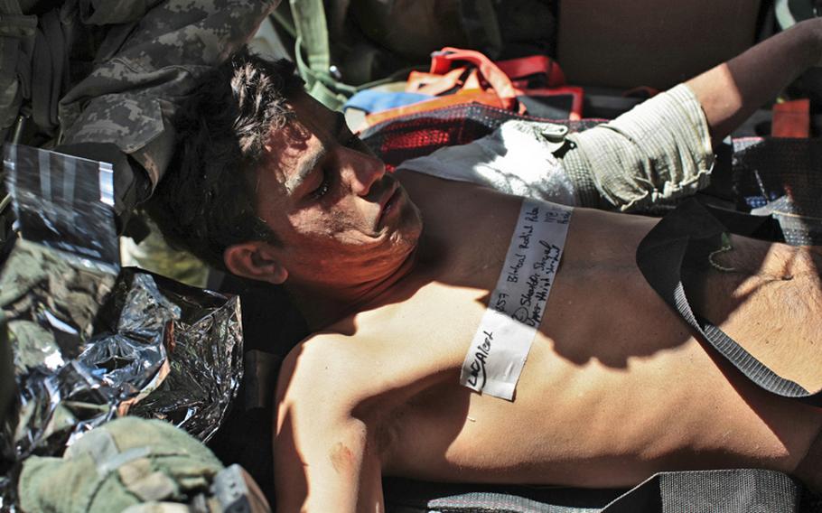 A wounded Afghan soldier is loaded onto a U.S. medical evacuation helicopter after being wounded Sept. 16 in a bomb blast in Zhari district, Kandahar province, Afghanistan.