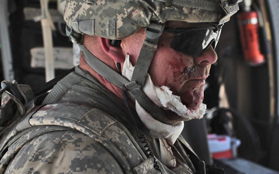 Sgt. 1st Class Ted Maust, of 2nd Brigade, 101st Airborne Division, is evacuated by a U.S. helicopter ambulance after being wounded Sept. 16 in a bomb blast in Zhari district, Kandahar province, Afghanistan. One Afghan soldier was killed in the blast, which also wounded about a dozen other U.S. and Afghan troops.