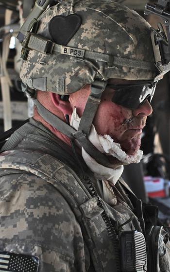 The side profile of a man with blood on his face
