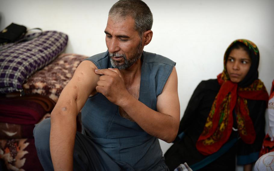 During a temporary stopover at a United Nations camp in Herat, Nazar Mohammed, 40, seen here in a photo from July 2014, points out injuries he sustained as a soldier fighting for Afghanistan's communist government in the 1990s. When the Taliban came to power he took his family to Iran, but more than a decade later they skipped meals to save money to return to Afghanistan.