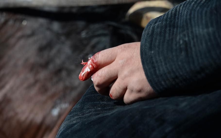 A buzkashi player rests his bloodied finger during a match outside Kabul on Thursday, Jan. 15, 2015. The game is highly physical with players and horses constantly colliding and sometimes falling.