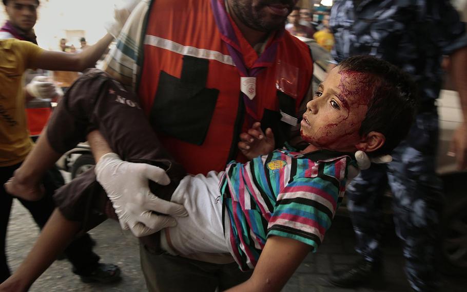 A boy who was wounded at the market in Shujayea, in Gaza City, is rushed to Shifa Hospital on Wednesday, July 30, 2014. 
