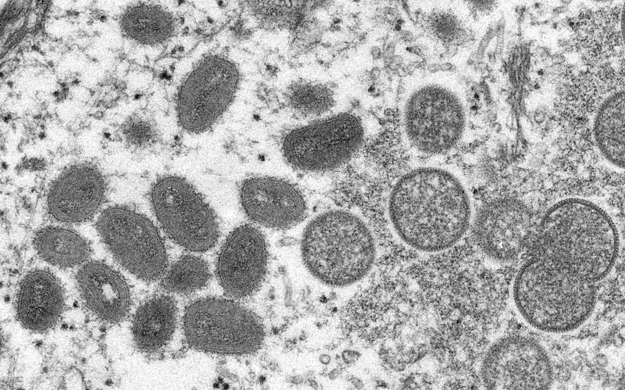 This electron microscopic (EM) image depicted a monkeypox virion, obtained from a clinical sample associated with the 2003 prairie dog outbreak. It was a thin section image from of a human skin sample. On the left were mature, oval-shaped virus particles, and on the right were the crescents, and spherical particles of immature virions. 