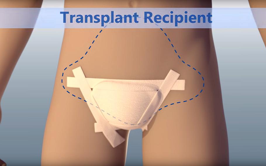 A screenshot from a Johns Hopkins Medicine video on how a penis transplant operation is performed.
