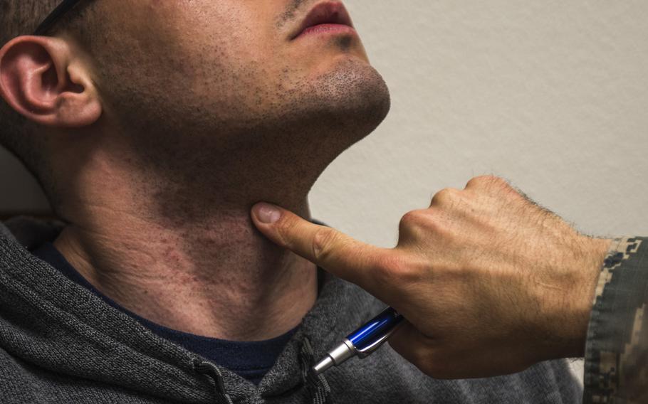 An airman raises his head as Lt. Col. David Gregory, 9th Medical Group chief of medical staff, inspects his neck and face during a shaving waiver course at Beale Air Force Base, Calif., in March 2018. Service members will no longer need a waiver to get laser treatments for severe razor bumps at a civilian facility, Tricare announced.