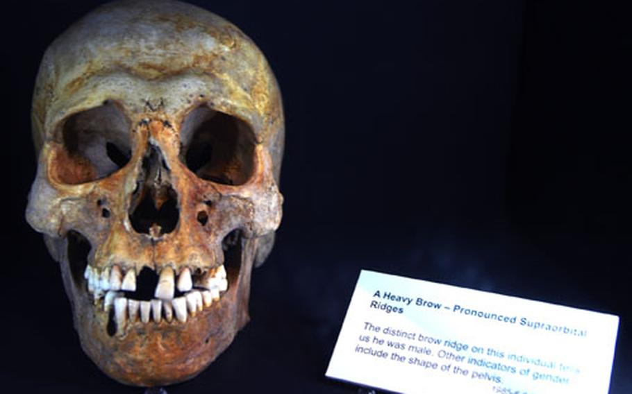 A Viking man&#39;s skull is on display at the Jorvik Viking Center.