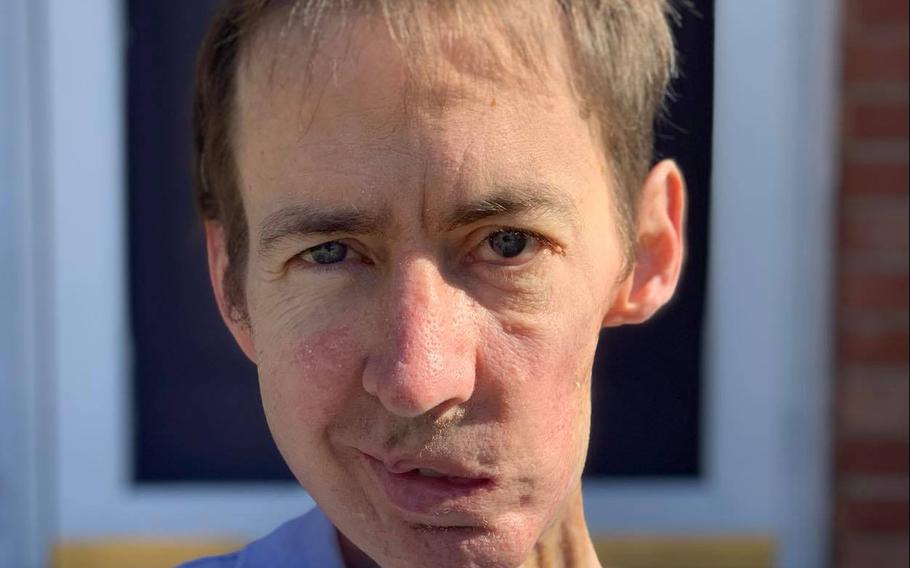 Former Air Force Maj. Brian Liebenow poses for a photo outside his home in Knoxville, Tenn., in November 2020. Liebenow had his left jawbone removed after it was severely damaged by radiation therapy for cancer. 


