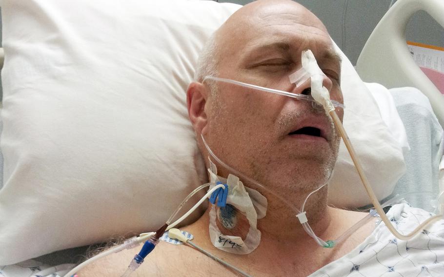 Army veteran David Sewell, seen here after surgery in 2013, said he was diagnosed that year with mesothelioma from asbestos. He believes he was exposed to asbestos during remediation work at Camp Walker, South Korea.